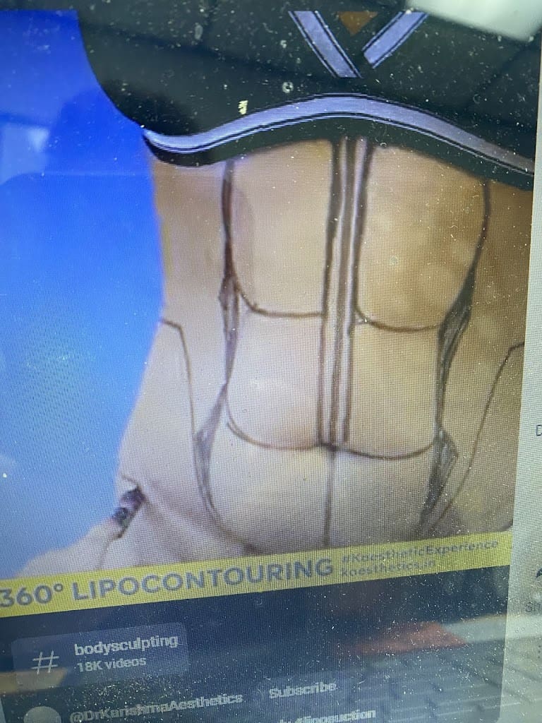 Celebrity Body Sculpting Aesthetics Medical Spa in Panama City Florida