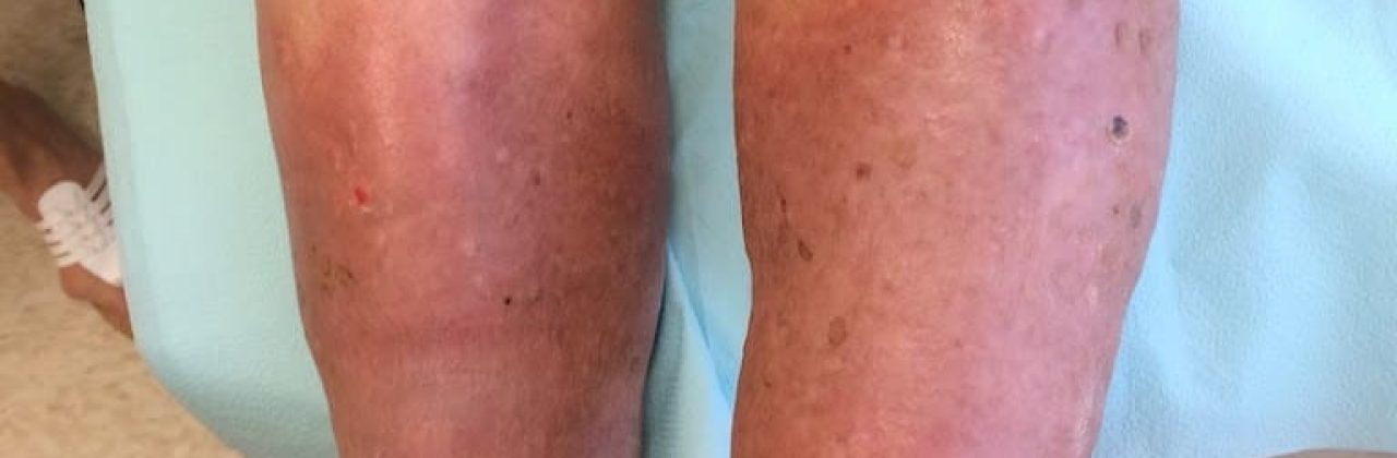 vascular medical equipment - Home Health Care Service in Gulf Breeze